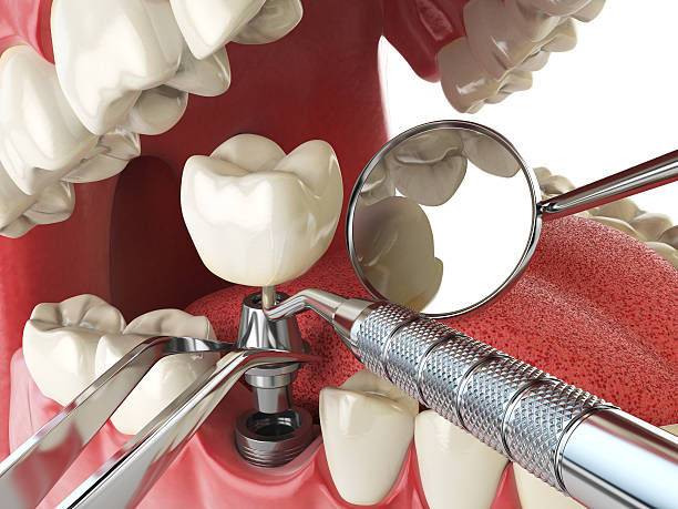 Best Emergency Treatment for Dental Infections or Abscesses in Park River, ND